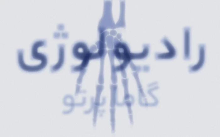 رادیولوژی - رادیولوژی در منزل - گاما پرتو