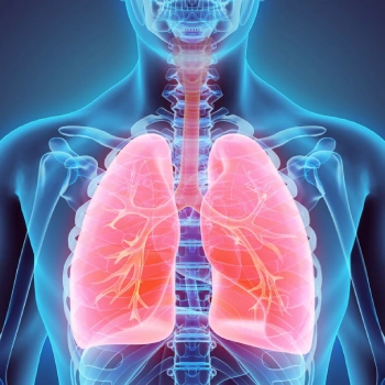 رادیولوژی ریه - رادیولوژی ریه در منزل - رادیولوژی ریه در خانه - گاما پرتو