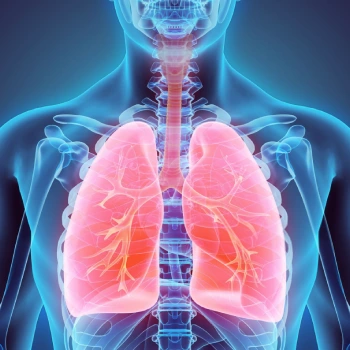 رادیولوژی قفسه سینه - رادیولوژی قفسه سینه در منزل - رادیولوژی قفسه سینه در خانه - گاما پرتو