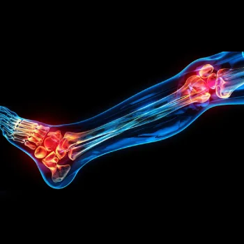 رادیولوژی پا - رادیولوژی پا در منزل - رادیولوژی پا در خانه - گاما پرتو