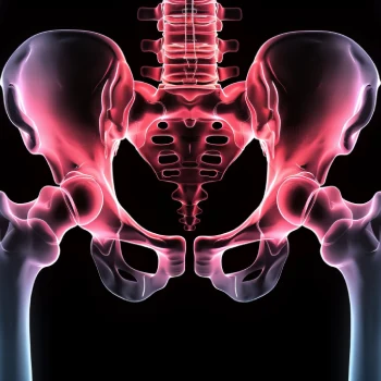 رادیولوژی استخوان های لگن - رادیولوژی استخوان های لگن در منزل - رادیولوژی استخوان های لگن در خانه - گاما پرتو