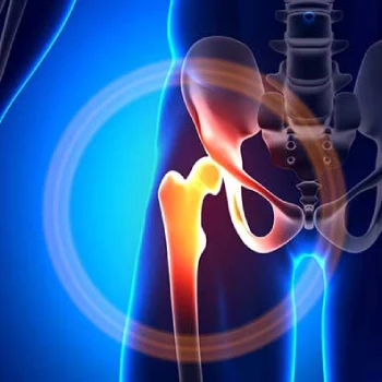 رادیولوژی مفصل لگن - رادیولوژی مفصل لگن در منزل - رادیولوژی مفصل لگن در خانه - گاما پرتو