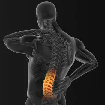 رادیولوژی مهره های کمر - رادیولوژی مهره های کمر در منزل - رادیولوژی مهره های کمر در خانه - گاما پرتو