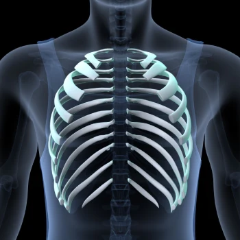 رادیولوژی دنده - رادیولوژی دنده در منزل - رادیولوژی دنده در خانه - گاما پرتو