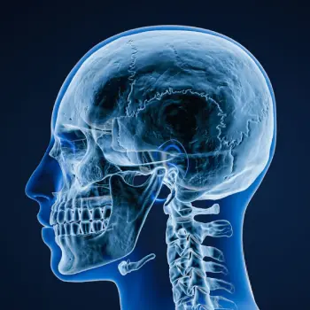 رادیولوژی جمجمه - رادیولوژی جمجمه در منزل - رادیولوژی جمجمه در خانه - گاما پرتو