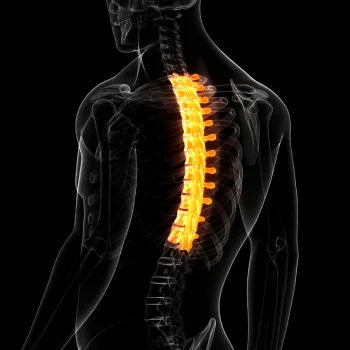 رادیولوژی مهره های پشتی - رادیولوژی مهره های پشتی در منزل - رادیولوژی مهره های پشتی در خانه - گاما پرتو