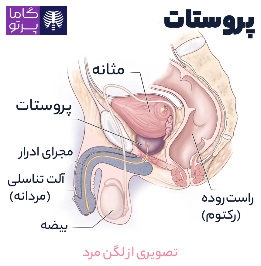 آناتومی و ویژگیهای پروستات - گاما پرتو