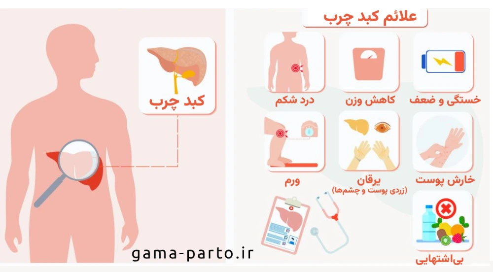 علائم بیماری کبد چرب چیست؟ - گاما پرتو