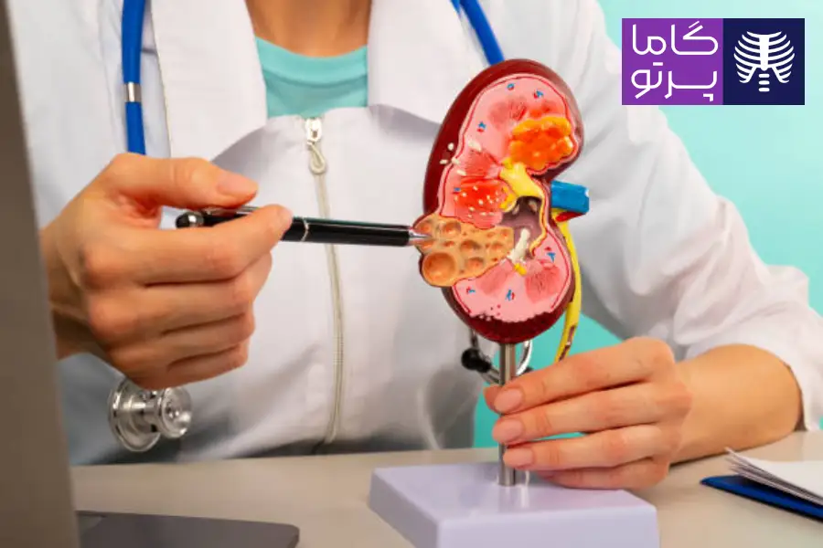 علل و عوامل خطر تشکیل سنگ کلیه - گاما پرتو
