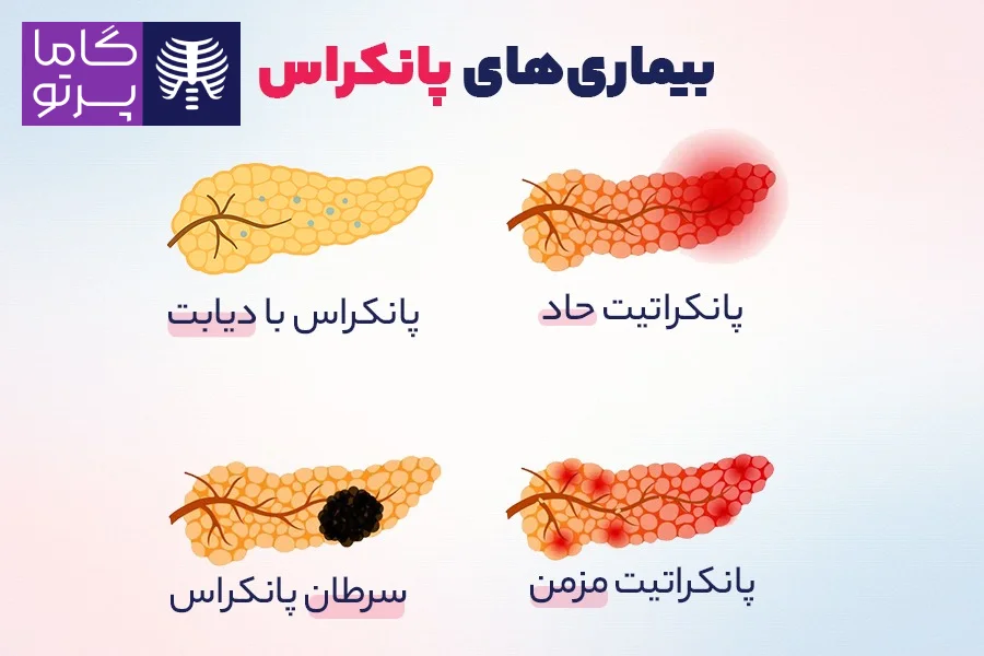 بیماریهای پانکراس چیست؟ - گاما پرتو