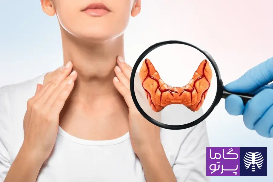 کم کاری تیروئید چیست؟ علائم، تشخیص و درمان آن - گاما پرتو