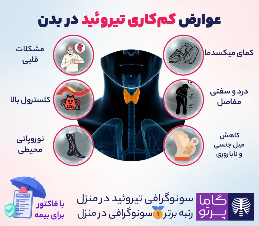 عوارض کم کاری تیروئید در بدن - گاما پرتو
