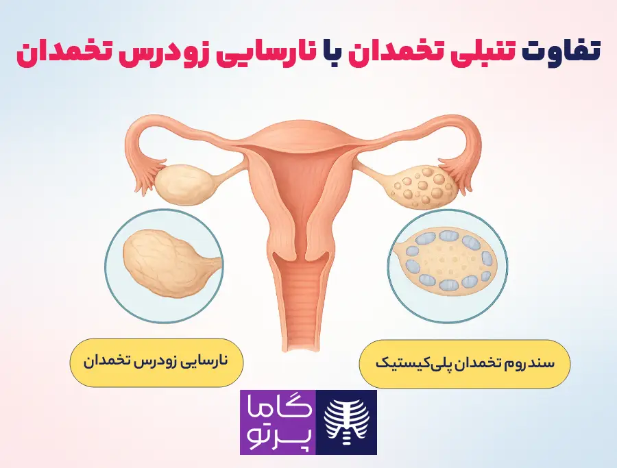 تنبلی تخمدان چیست و چه تفاوتی با نارسایی زودرس تخمدان دارد؟ - گاما پرتو