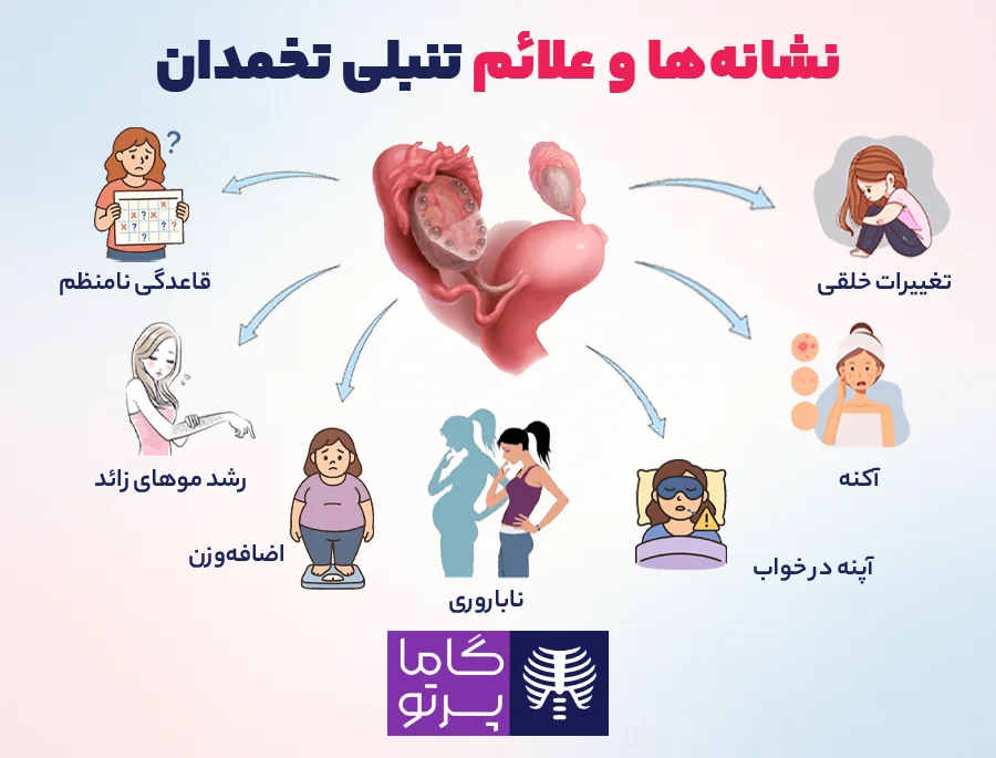 علائم و نشانههای تنبلی تخمدان - گاما پرتو
