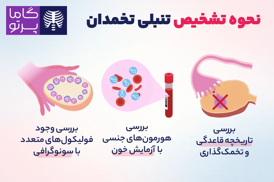 نحوه تشخیص تنبلی تخمدان - گاما پرتو