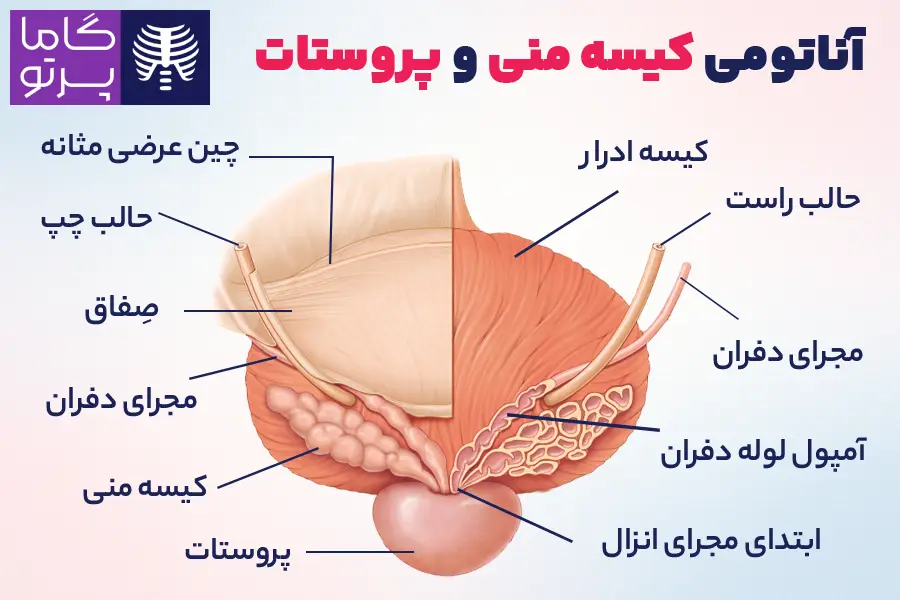 آناتومی کیشه منی و پروستات - گاما پرتو