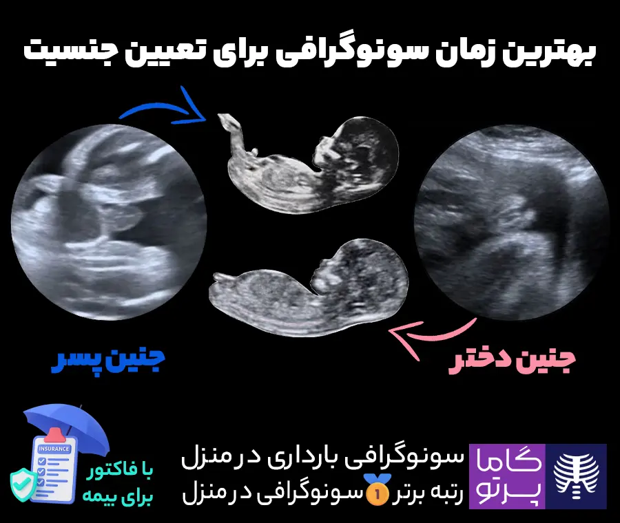 بهترین زمان سونوگرافی برای تعیین جنسیت جنین - گاما پرتو