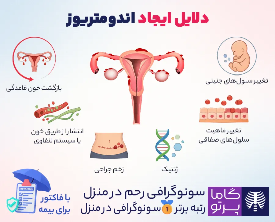 دلایل بروز اندومتریوز - گاما پرتو