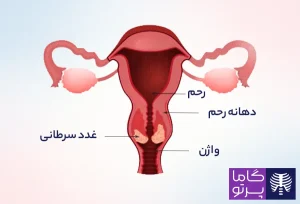 سرطان دهانه رحم چیست؟ علائم، روشهای تشخیص آن - گاما پرتو