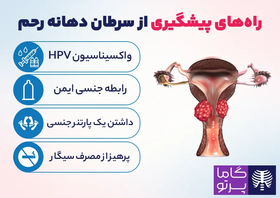 راههای پیشگیری از سرطان دهانه رحم - گاما پرتو